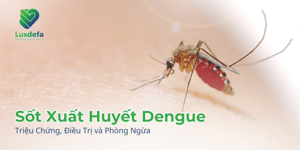 Sốt Xuất Huyết Dengue: Triệu Chứng, Điều Trị và Phòng Ngừa