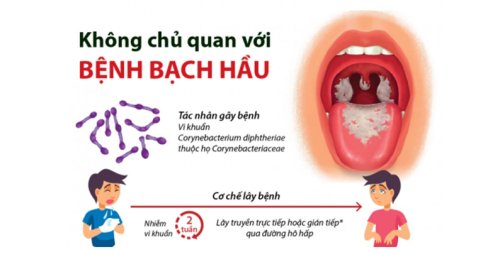 BỆNH BẠCH HẦU: NGUYÊN NHÂN TRIỆU CHỨNG VÀ BIỆN PHÁP PHÒNG NGỪA