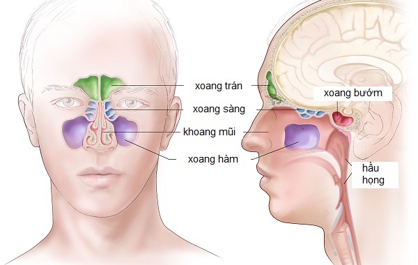 Viêm xoang: Nguyên nhân và cách điều trị hiệu quả