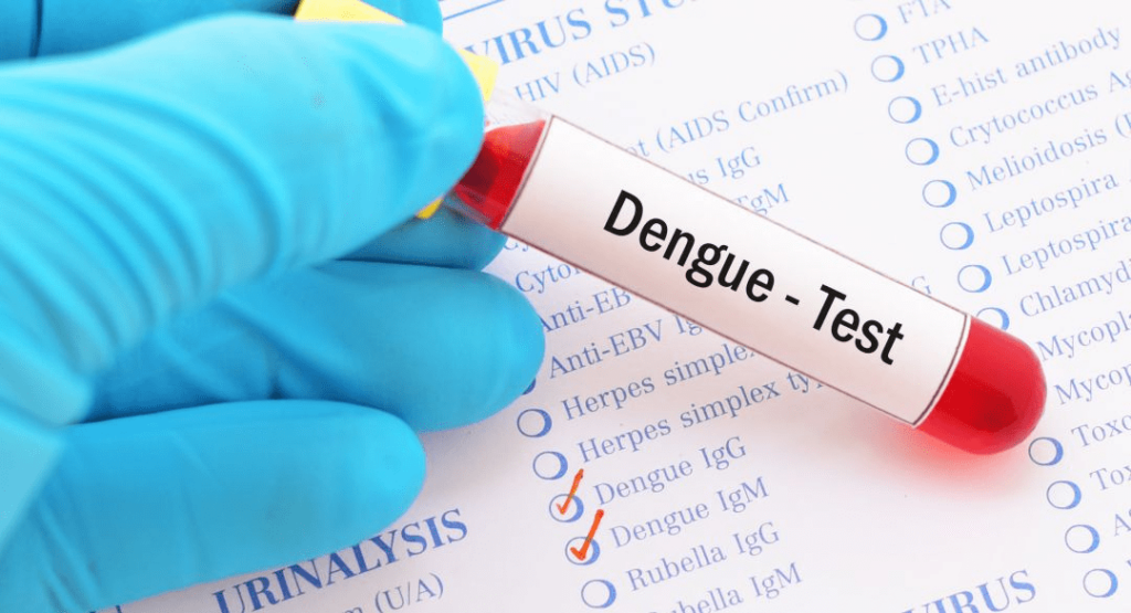 Sốt Xuất Huyết Dengue: Triệu Chứng, Điều Trị và Phòng Ngừa