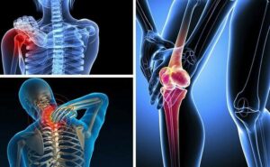 Điều trị bệnh thoái hoá khớp