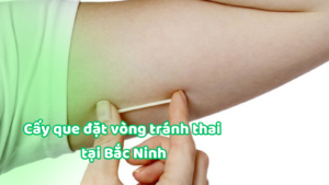 Cấy que đặt vòng tránh thai tại Bắc Ninh