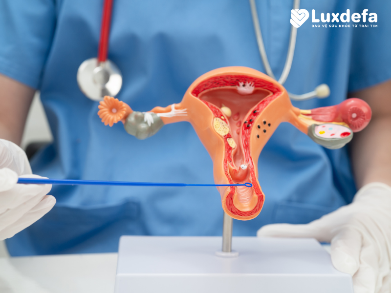 Điều trị viêm phụ khoa tại Bắc Ninh