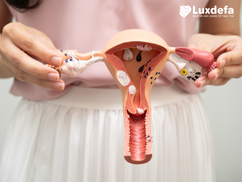 chữa viêm phụ khoa tại Bắc Ninh