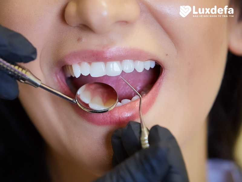 khám răng miệng định kỳ tại Bắc Ninh